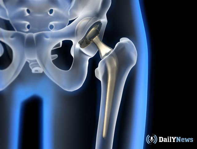 Российские ученые рассказали о создании импланта, который идентичен натуральной человеческой кости