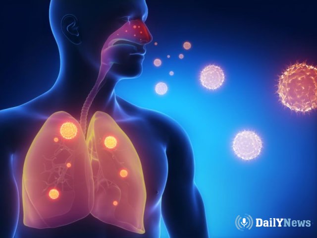 Более 100 жителей Удмуртии заболели пневмонией в течении первых дней ноября