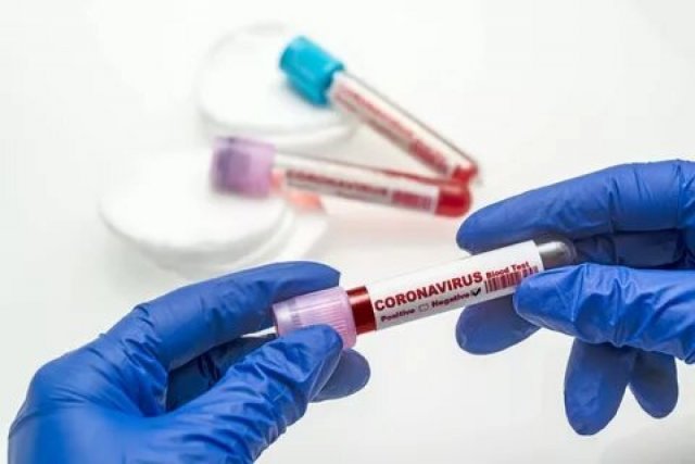 Систему тестирования на коронавирус на дому начали использовать в России