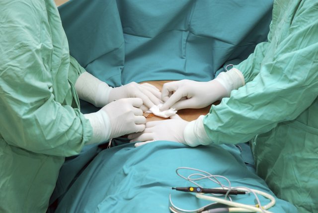 Хирурги призывают пациентов с грыжами не отказываться от плановых операций