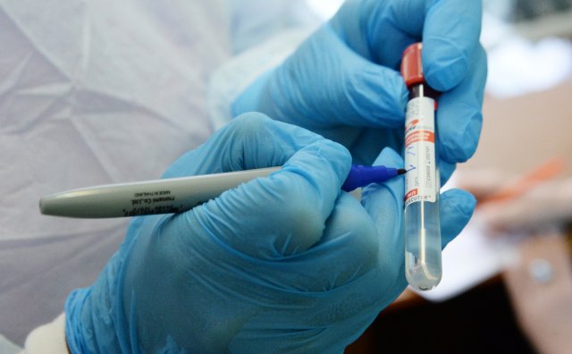 Как отличить повторное заражение коронавирусом от рецидива рассказал врач-эпидемиолог