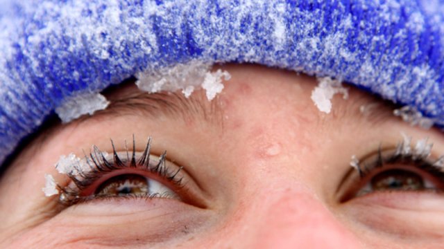Что такое снежная болезнь и чем она опасна, рассказал офтальмолог
