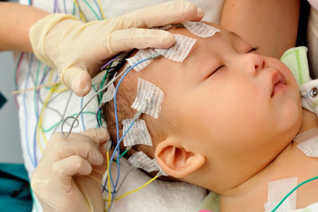 Учёные из Саратова разработали новый способ лечения травм мозга у новорожденных