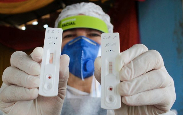 Экспресс-тест на определение коронавируса разработали учёные из Японии и России
