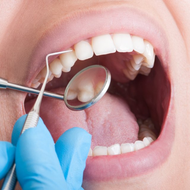 В Бельгии предупредили о неквалифицированных стоматологах