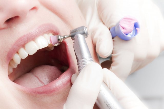Эксперт назвал оптимальную частоту проведения профессиональной гигиены полости рта